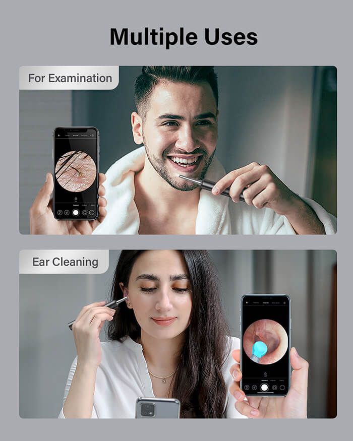 Nettoyeur d'Oreille Rechargeable avec Camera HDimage 4